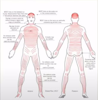 biodynamic excisional skin tension BEST lines