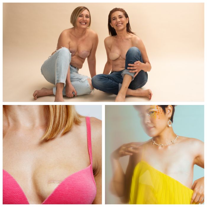 mastectomy breast cancer scar tissue therapy in long island