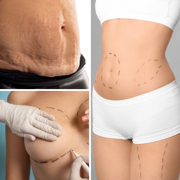 post plastic surgery recovery treatment long island