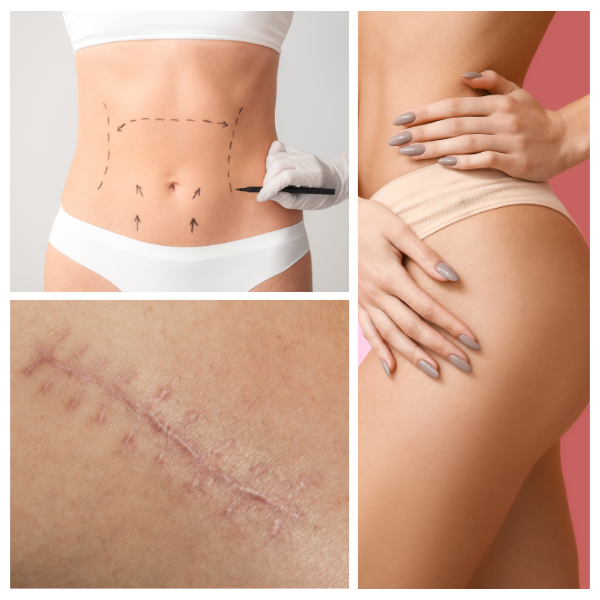 post plastic surgery recovery and scar release therapy